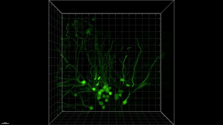 Mouse hippocampus Mouse hippocampus